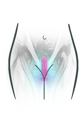What are the differences between Magnetic and Non Magnetic Dilators?