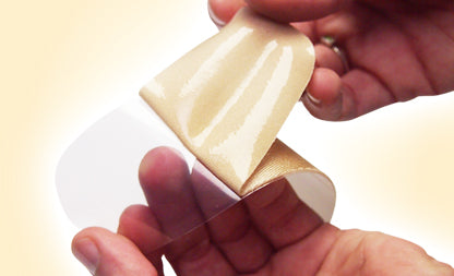 Traitement des cicatrices de césarienne en tissu Oleeva®