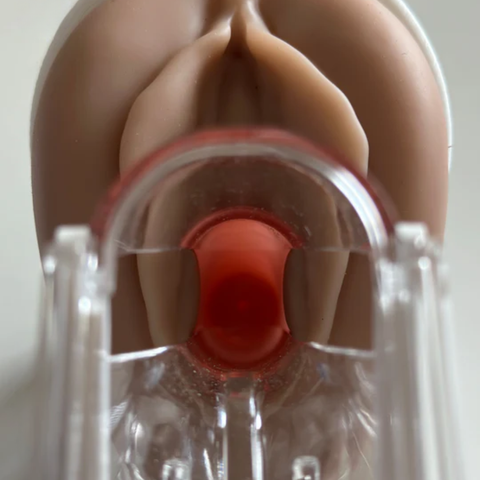 Venus™ Pelvic Health Educational Model